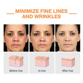 HACIRFE dropper dispensing serum demonstrates precise dosage and ease