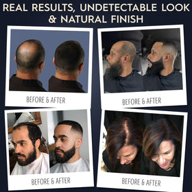 Hair Illusion filling patchy beard area for fuller, natural facial hair
