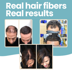 Hair Illusion before and after top view, demonstrates reduced scalp visibility