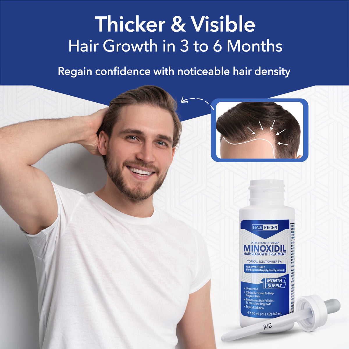 Applying Hair Regen to crown area with dropper, targeted scalp coverage benefit