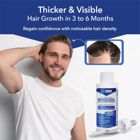 Applying Hair Regen to crown area with dropper, targeted scalp coverage benefit