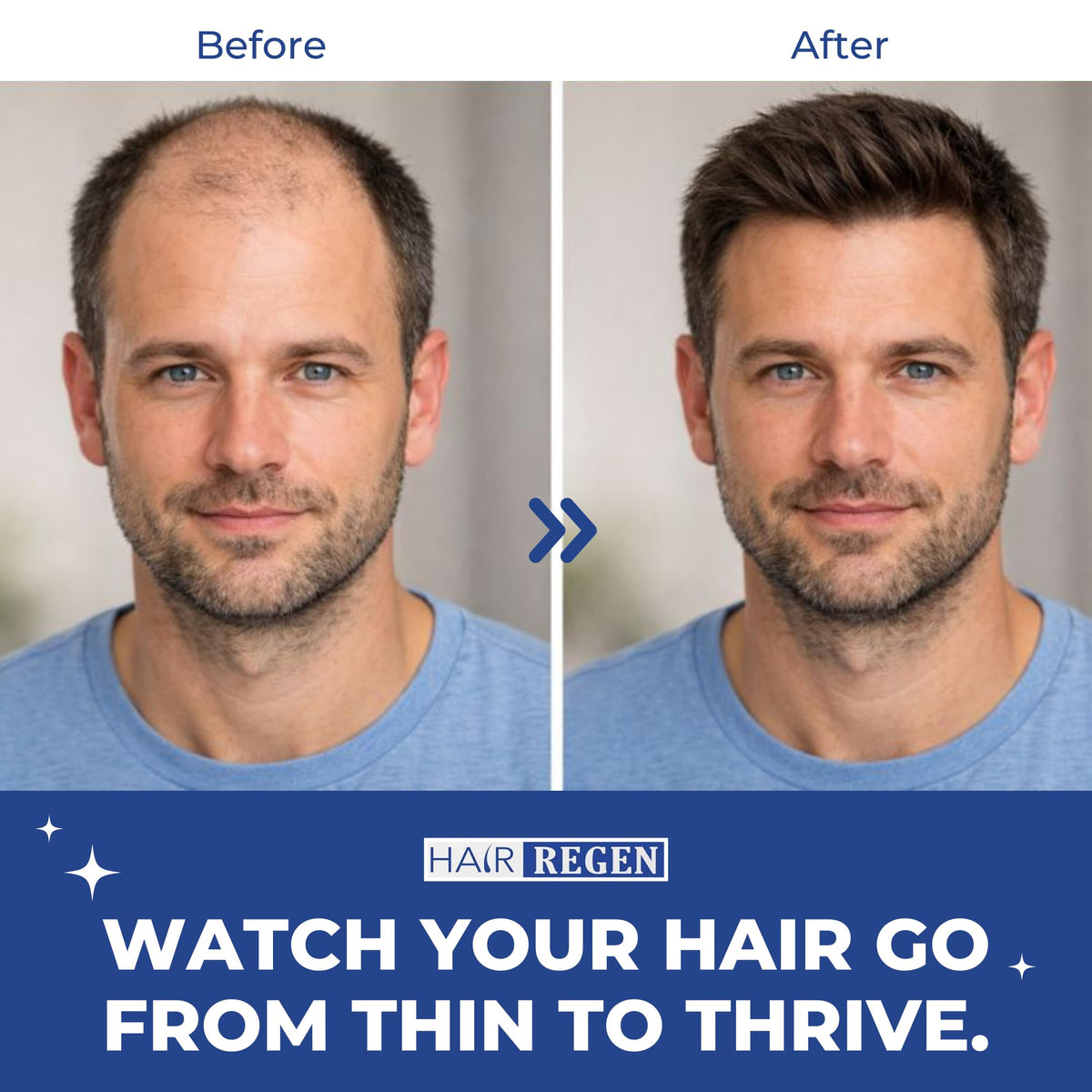 Hair Regen in-use application on scalp demonstrating easy daily routine