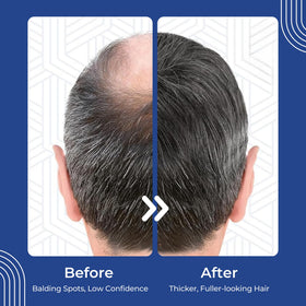 Hair Regen bottle in hand showing size and monthly supply clarity