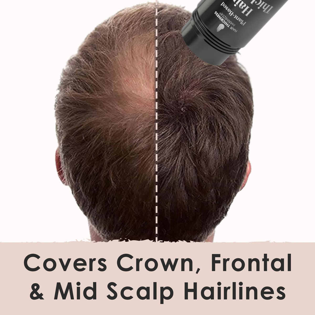 Hair Thickness Maximizer applying to hairline demonstrating natural blend