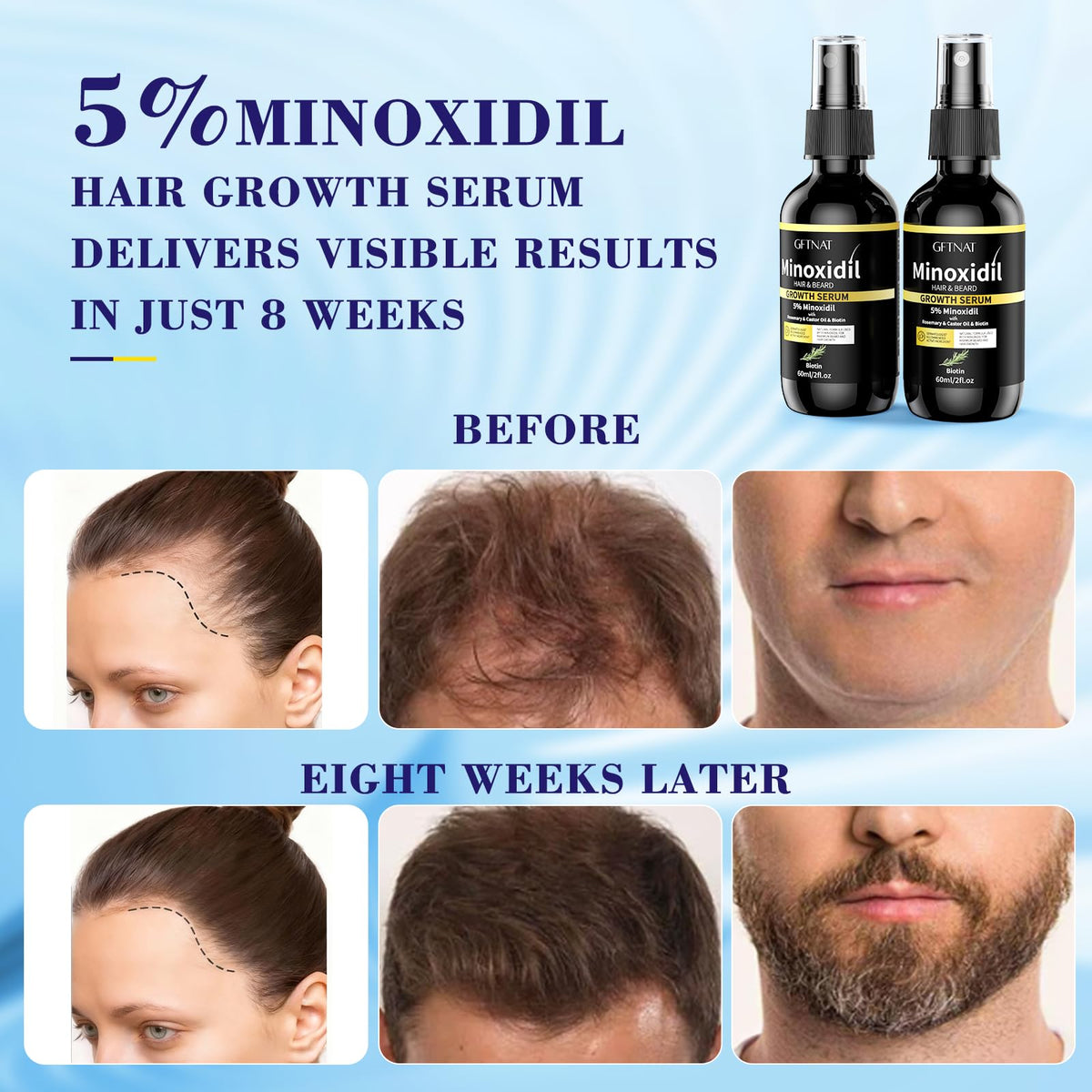 Minoxidil half bottle scale comparison showing portable 1.96 fl oz size