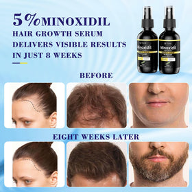 Minoxidil half bottle scale comparison showing portable 1.96 fl oz size