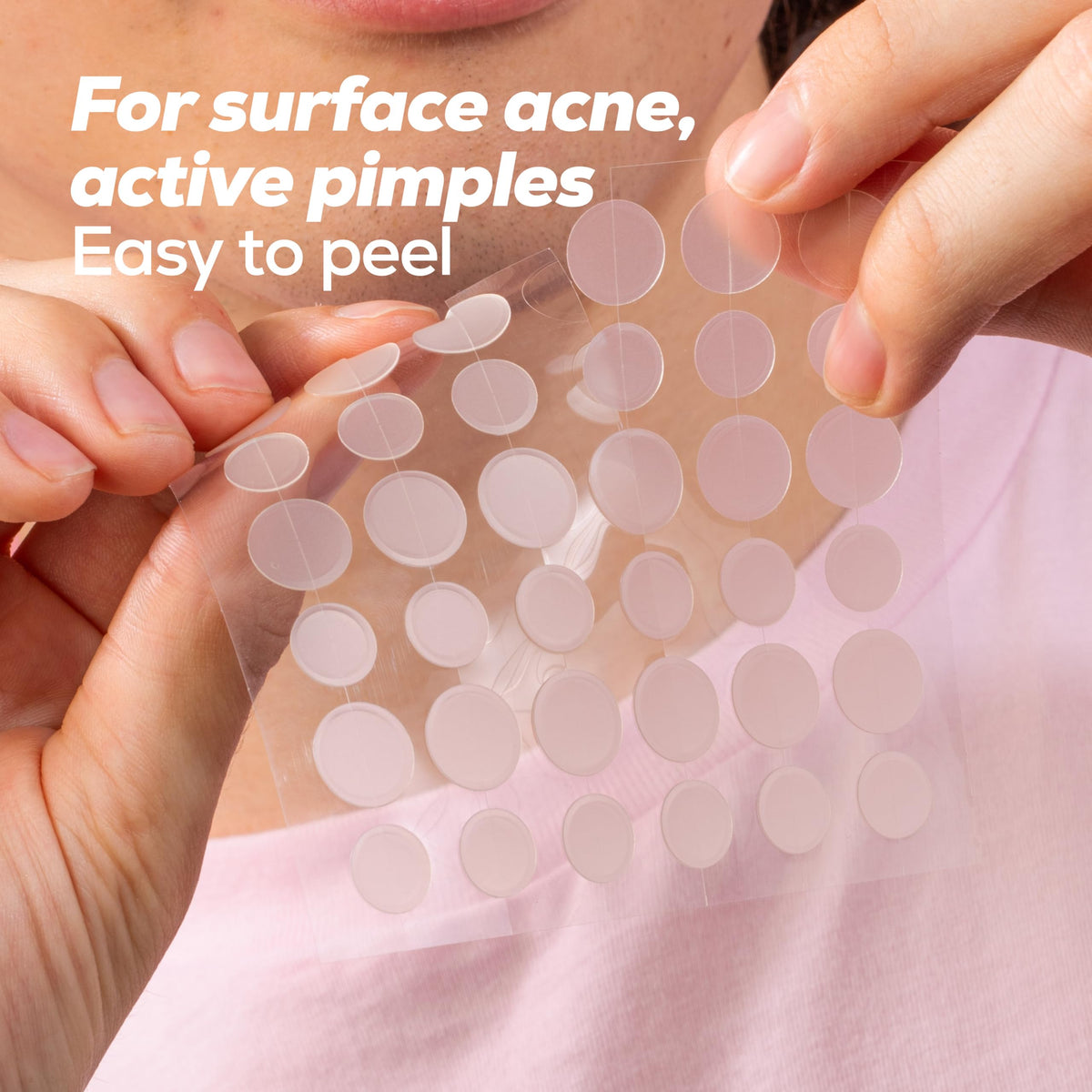 HANHOO 10mm and 12mm patches side-by-side showing size options for varied blemishes