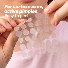 HANHOO 10mm and 12mm patches side-by-side showing size options for varied blemishes