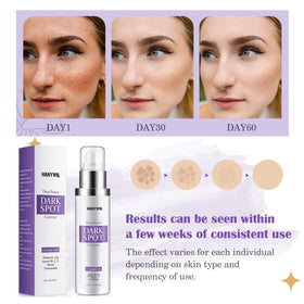 HANYWIL applying serum to cheek demonstrating targeted reduction of discoloration
