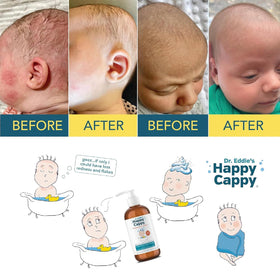 Happy Cappy used during baby bath routine illustrating comforting bath-time benefit