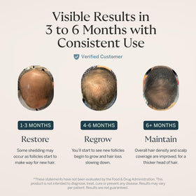 Happy Head capsule in hand to show real scale and easy daily use convenience