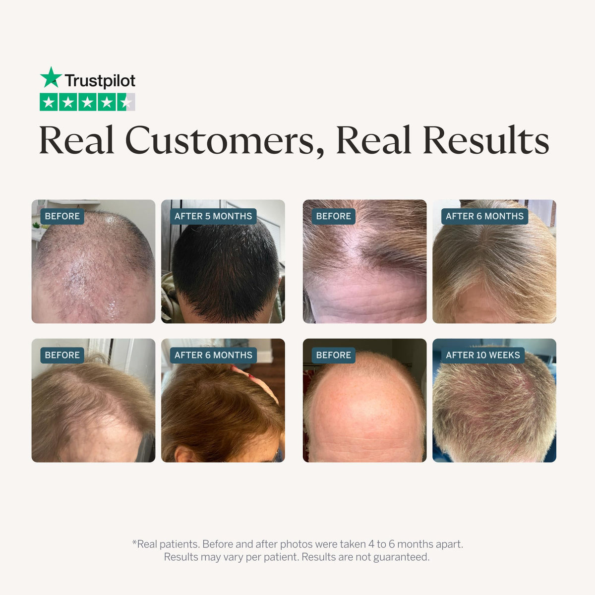 Happy Head dropper applying serum to scalp, demonstrates precise targeted application benefit