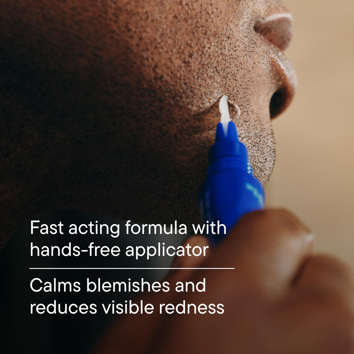 Harry's spot gel applied on a cheek to target a blemish with precise coverage benefit