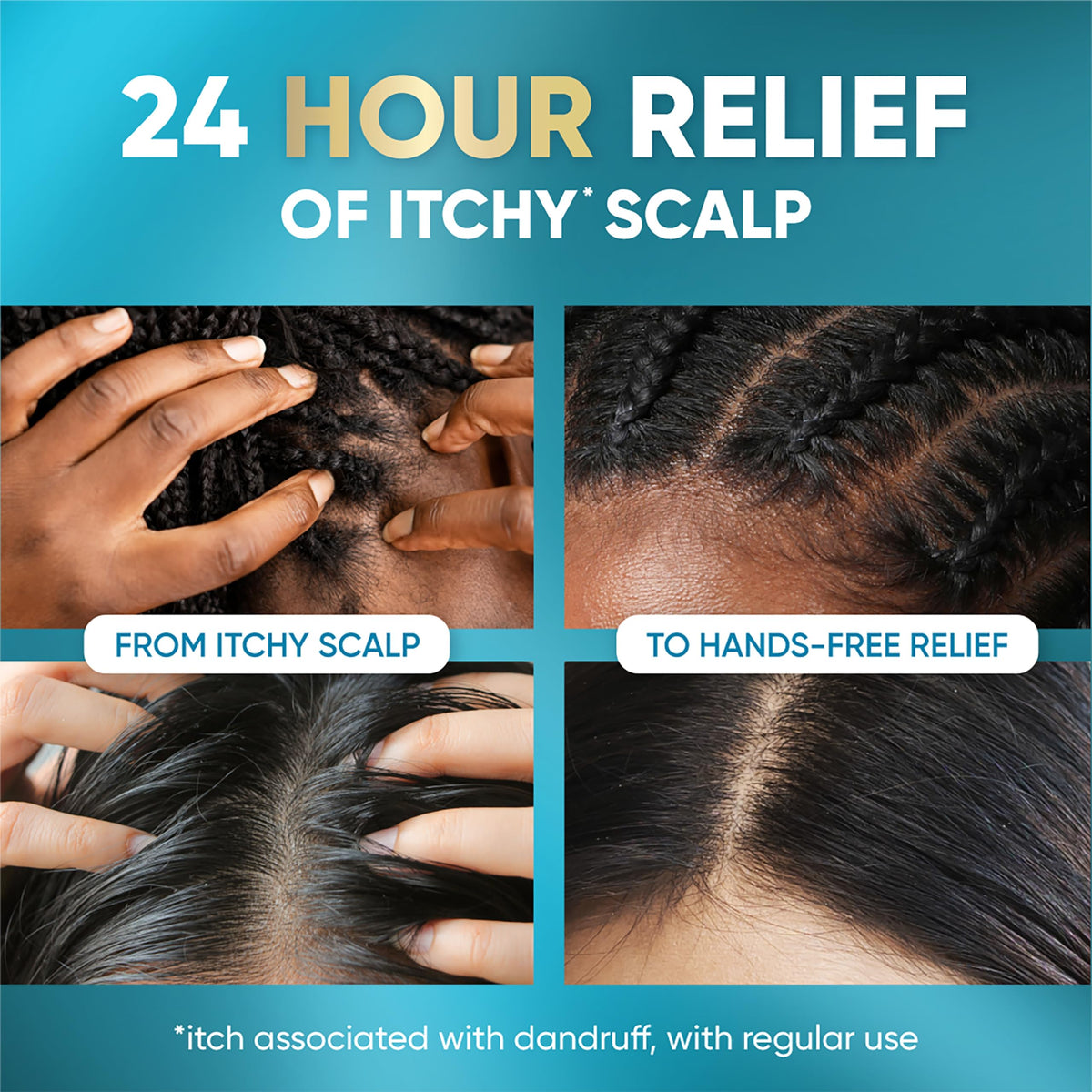 Head & Shoulders applied to scalp demonstrating targeted relief