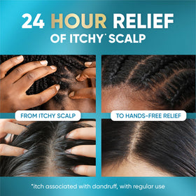 Head & Shoulders applied to scalp demonstrating targeted relief