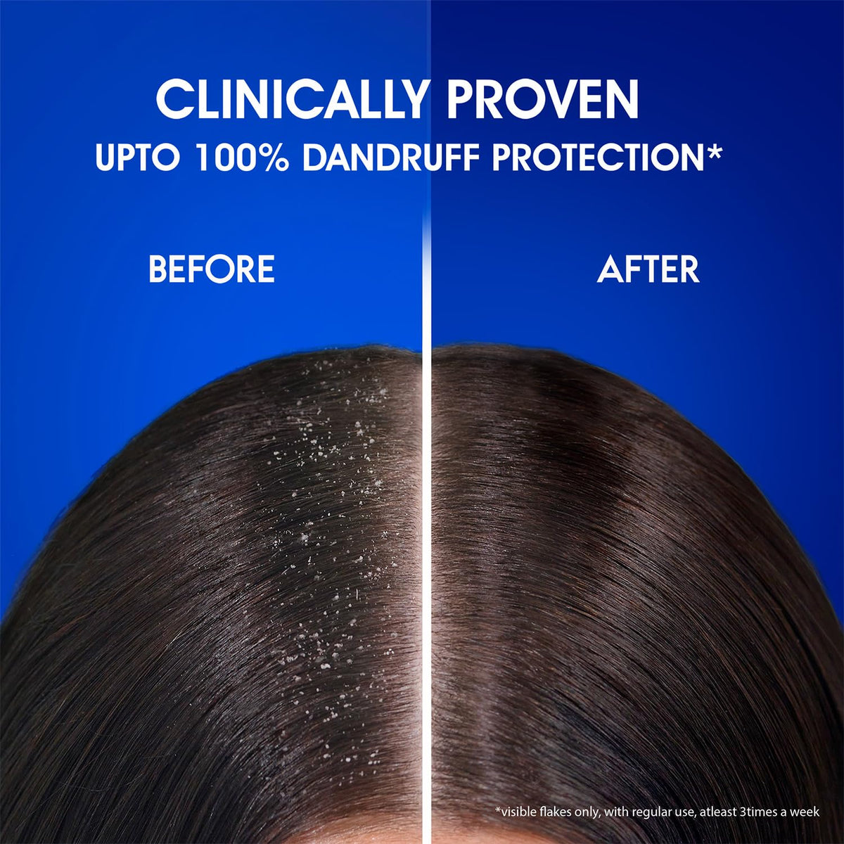 Illustrative before and after scalp image implying reduced visible flakes