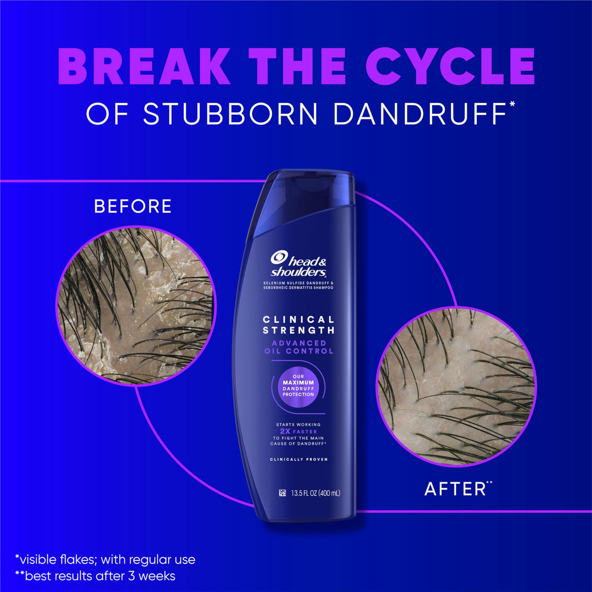 Head & Shoulders clinical shampoo texture close-up showing rich lather benefit