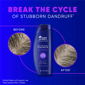 Head & Shoulders clinical shampoo texture close-up showing rich lather benefit