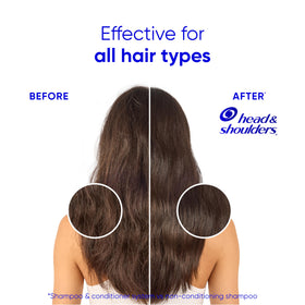 Head & Shoulders before and after hair comparison showing reduced flakes and shine