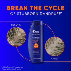 Head & Shoulders bottle with manuka honey imagery highlighting soothing moisturizing benefit