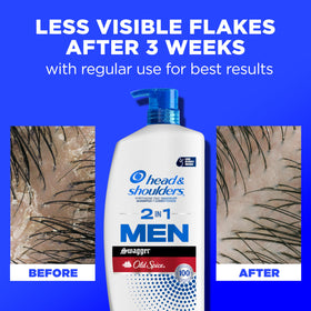 Head & Shoulders lather on palm showing conditioning texture and smoothness