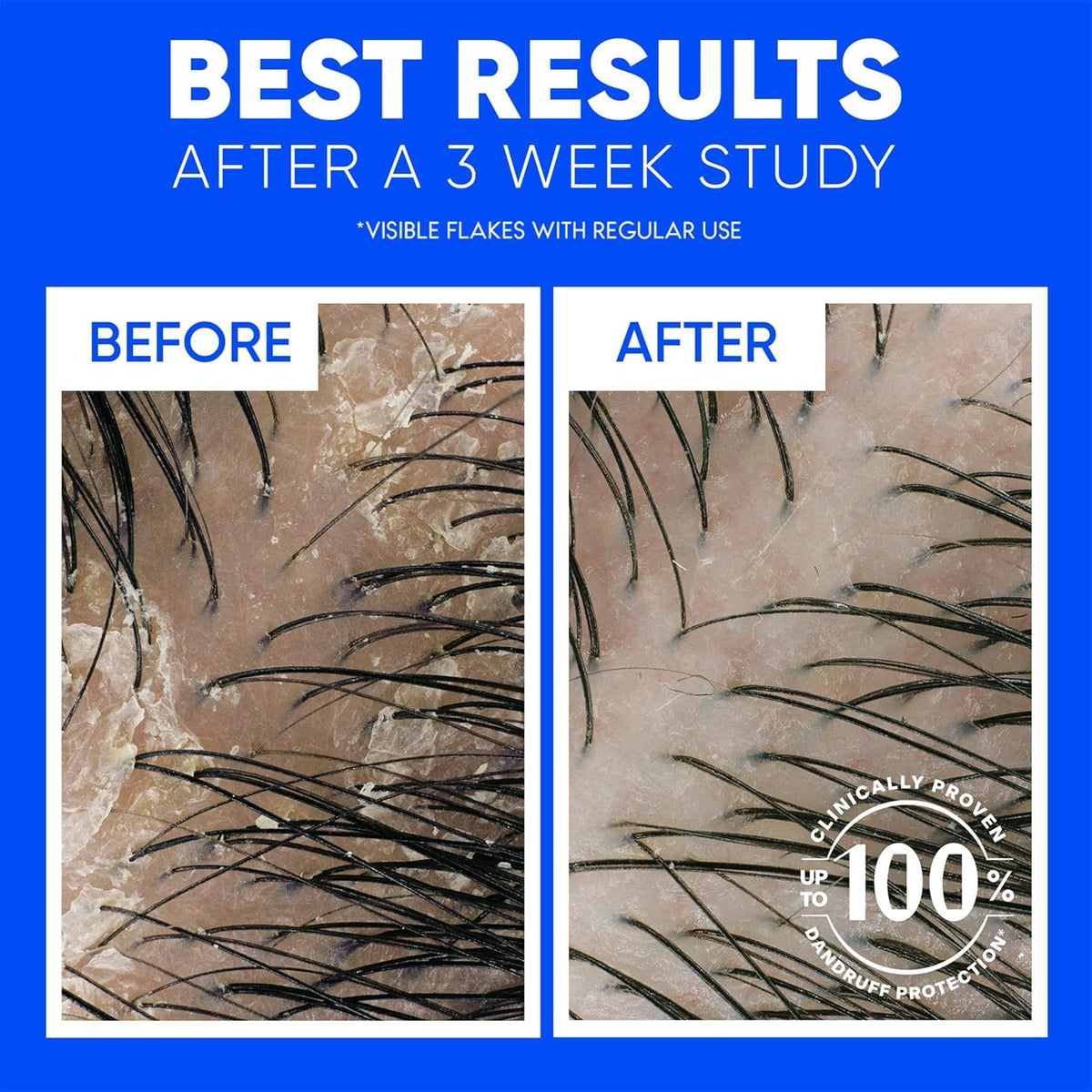 Pouring Head & Shoulders shampoo into palm showing creamy texture