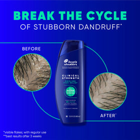 Head & Shoulders shampoo lather texture illustrating creamy cleansing and cooling feel