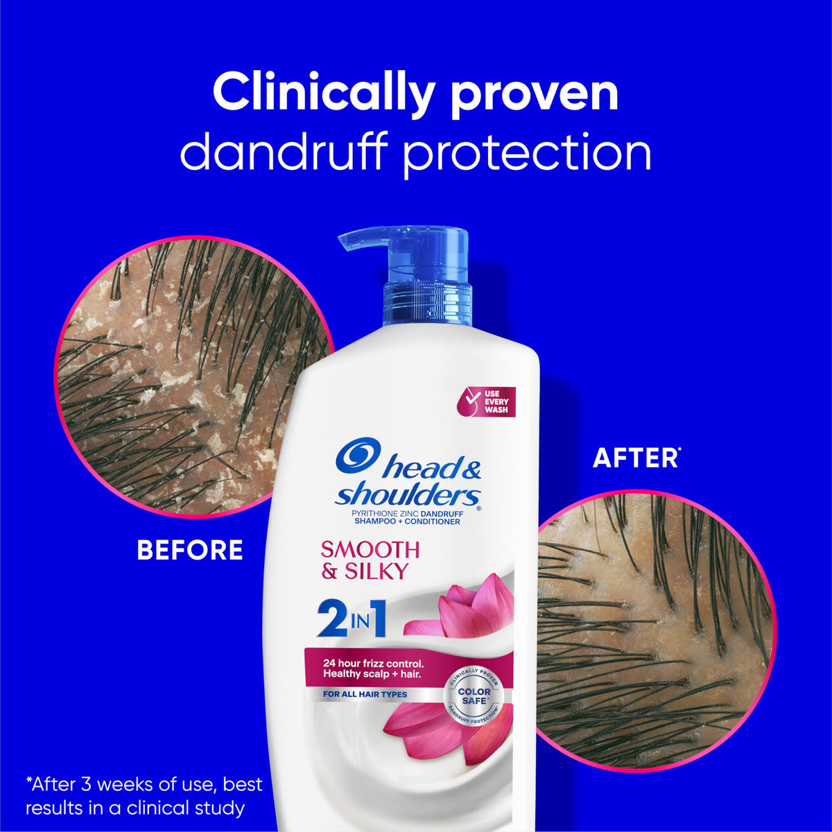 Head & Shoulders cap and dispenser detail showing spill-free, user-friendly design