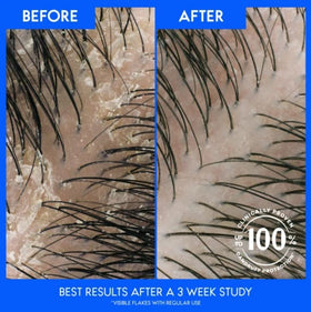 Head & Shoulders lifestyle image after workout showing clean scalp confidence