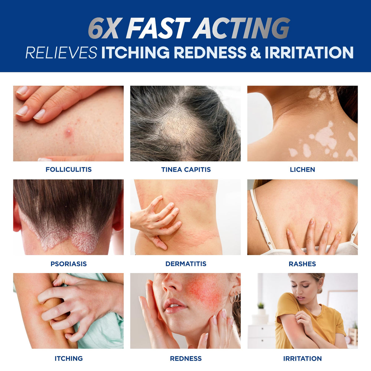 Hermon applied to scalp demonstrating targeted follicle care and convenient application