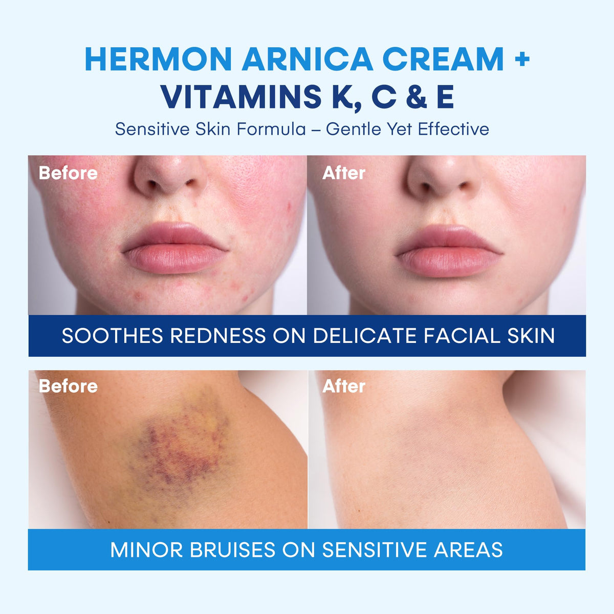 Back of Hermon packaging showing directions and usage information for targeted application