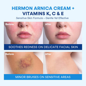 Back of Hermon packaging showing directions and usage information for targeted application