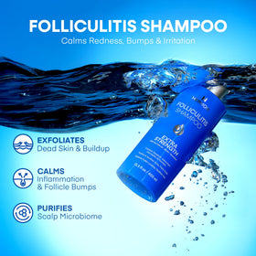 Hermon ingredients list showing active components for targeted scalp relief