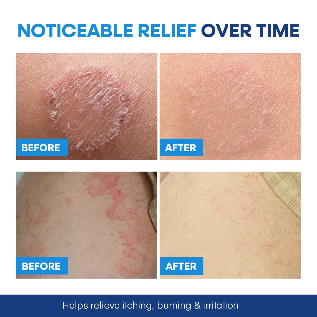 Hermon soap in hand demonstrating easy application and control
