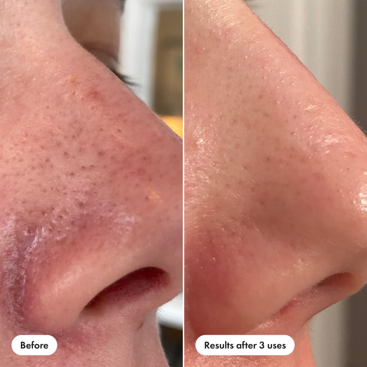HERO COSMETICS product staged with aloe and lotus water ingredients
