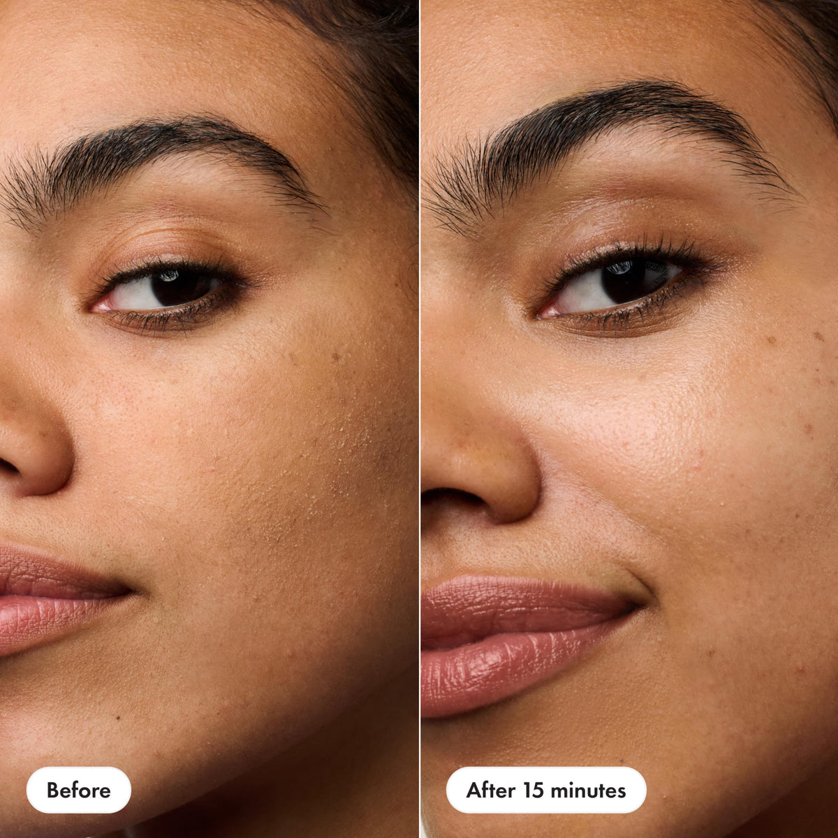 HERO COSMETICS adhesive patch edge illustrating secure facial fit
