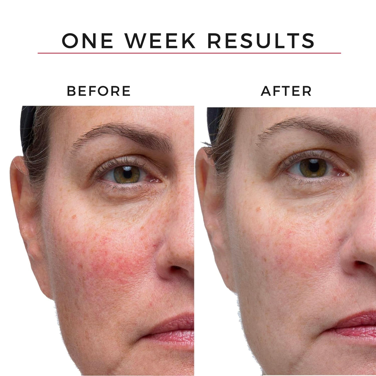 Hey Honey silky serum texture on skin highlighting lightweight hydration benefit