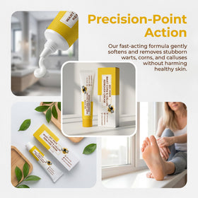 HHWZOH cream applied to heel close-up, demonstrating targeted softening benefit