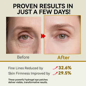 Hicream hydrogel texture close-up highlighting thin flexible patch comfort