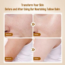 Hicream ingredients honey and beeswax arranged to show natural benefits