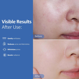 Hicream pad soaked in serum illustrating concentrated actives and hydration