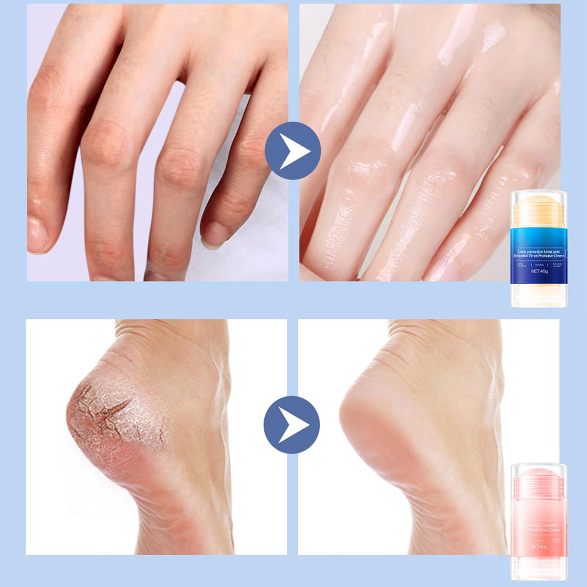HJXUQIME blue repair stick texture close-up for softening calluses