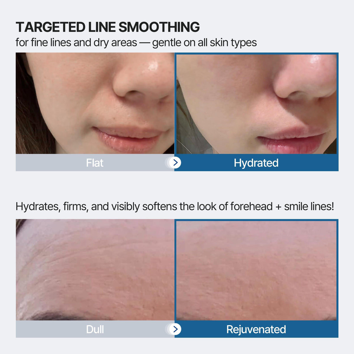 Honeydew Labs forehead patch applied for smoothing and overnight hydration