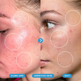 Honeydew Labs fine mist texture demonstrating gentle coverage