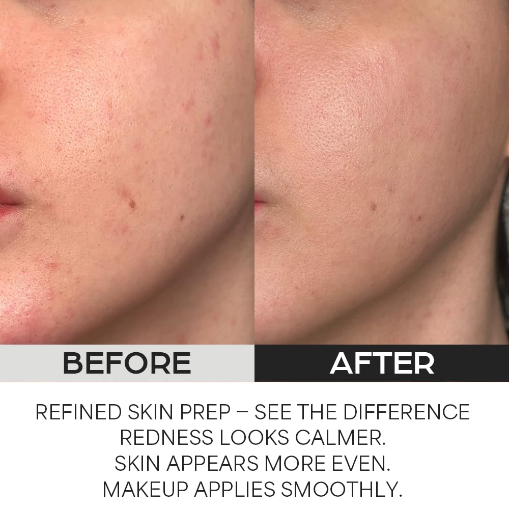 House of Hur red beet extract imagery indicating soothing hydration and redness relief