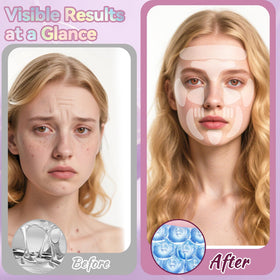 HULEIWA forehead patch application showing easy placement and smoothing