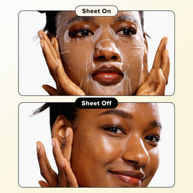 I DEW CARE mask applied on model demonstrating comfortable fit and calming effect