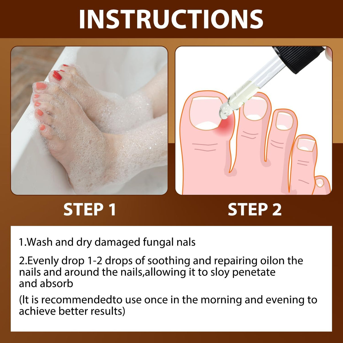 Iaolose in use on toenail showing careful application and eased nail-edge tension