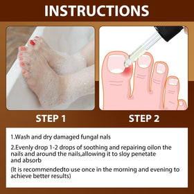 Iaolose in use on toenail showing careful application and eased nail-edge tension