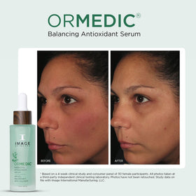 IMAGE Skincare serum texture on hand highlighting lightweight fast absorption benefit